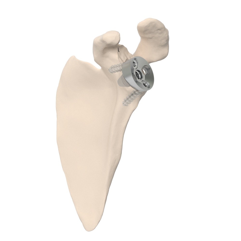 Image for 